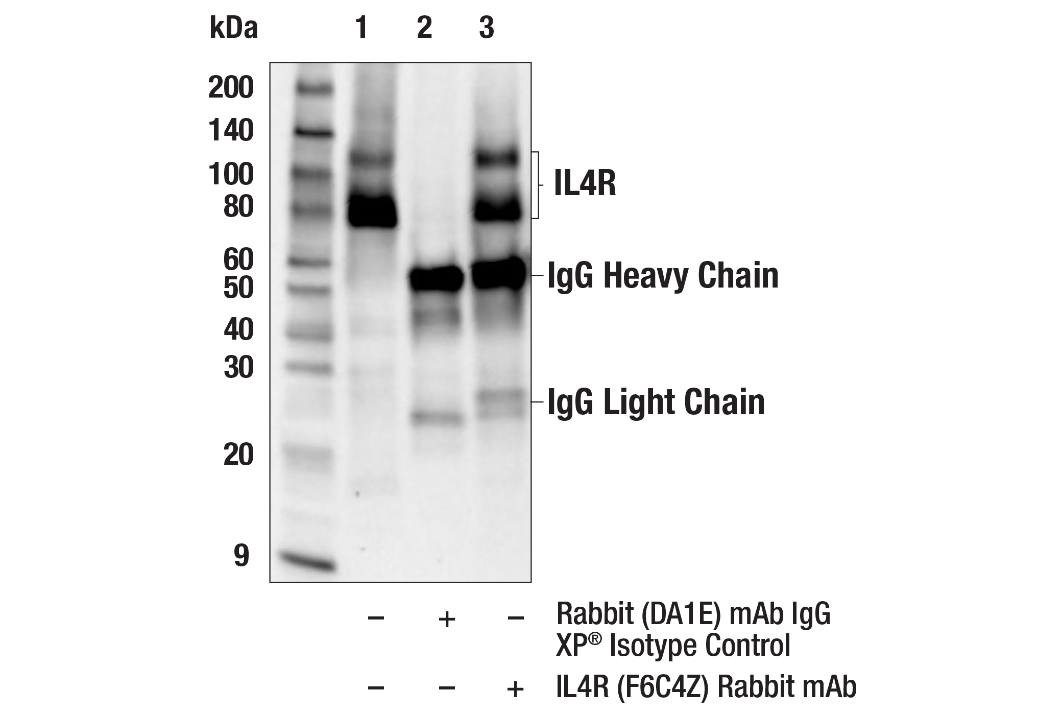 Immunoprecipitation Image 1: IL4R (F6C4Z) Rabbit mAb