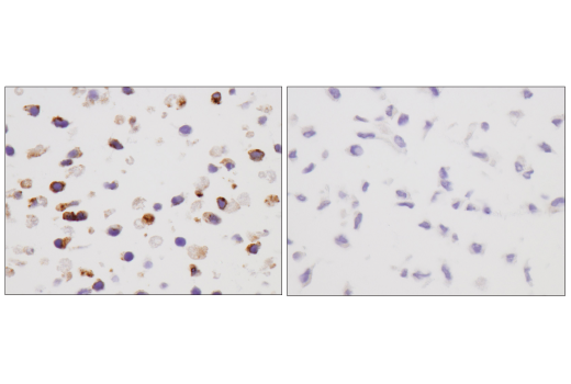 Immunohistochemistry Image 5: VISTA (D5L5T) XP® Rabbit mAb (BSA and Azide Free)