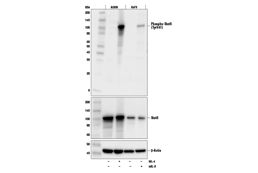 Western Blotting Image 1: Phospho-Stat6 (Tyr641) (D8S9Y) Rabbit mAb (BSA and Azide Free)