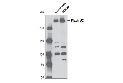  Image 4: Plexin Isoform Antibody Sampler Kit