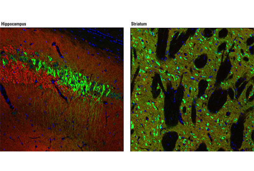 Immunofluorescence Image 1: Non-phospho-STEP (Ser221) (D74H3) XP® Rabbit mAb