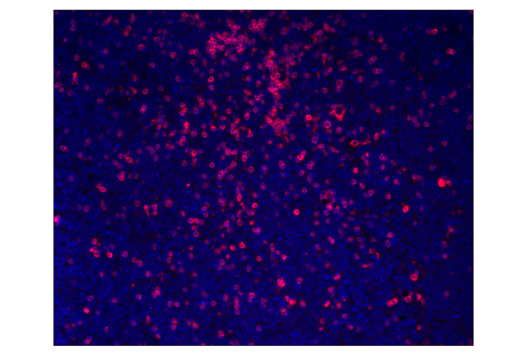 Immunohistochemistry Image 1: CD3ε (E4T1B) XP® Rabbit mAb (Alexa Fluor® 555 Conjugate)