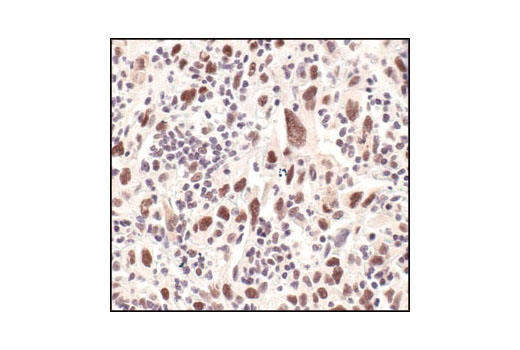 Immunohistochemistry Image 2: Survivin (71G4B7) Rabbit mAb (BSA and Azide Free)