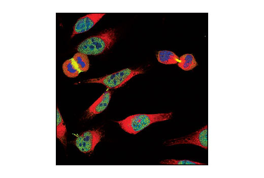 Immunofluorescence Image 1: Survivin (71G4B7) Rabbit mAb (BSA and Azide Free)