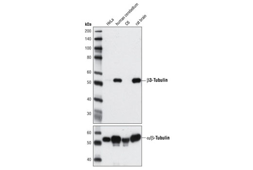 Western Blotting Image 1: β3-Tubulin (D65A4) XP® Rabbit mAb
