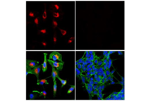 Immunofluorescence Image 1: Notch2 (D76A6) XP® Rabbit mAb (Alexa Fluor® 555 Conjugate)