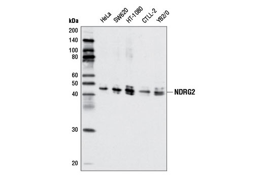 Western Blotting Image 1: NDRG2 Antibody