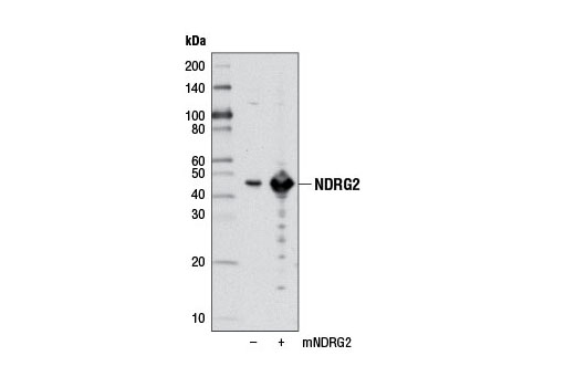 Western Blotting Image 2: NDRG2 Antibody