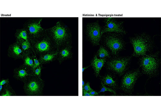 Immunofluorescence Image 1: STIM1 (D88E10) Rabbit mAb