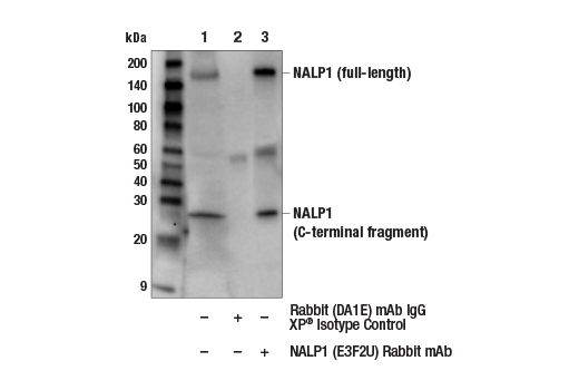 Immunoprecipitation Image 1: NALP1 (E3F2U) Rabbit mAb