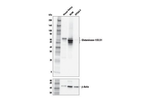 Western Blotting Image 1: Glutaminase-1/GLS1 (E9H6H) XP® Rabbit mAb