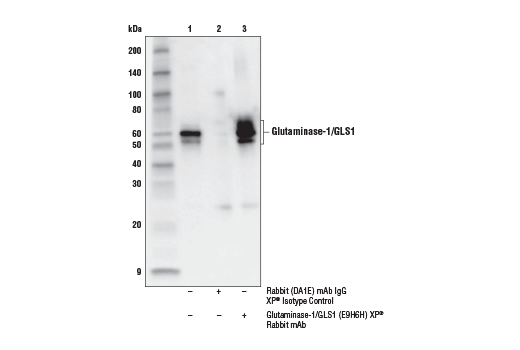 Immunoprecipitation Image 1: Glutaminase-1/GLS1 (E9H6H) XP® Rabbit mAb