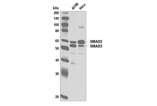 Western Blotting Image 1: SMAD2/3 Antibody