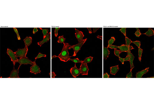 Immunofluorescence Image 1: SMAD2/3 Antibody