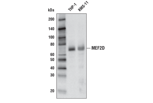 Western Blotting Image 1: MEF2D Antibody