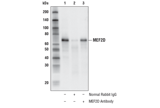Immunoprecipitation Image 1: MEF2D Antibody