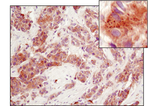 Immunohistochemistry Image 1: PERK (D11A8) Rabbit mAb