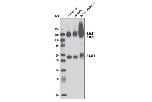  Image 7: Astrocyte Markers Antibody Sampler Kit