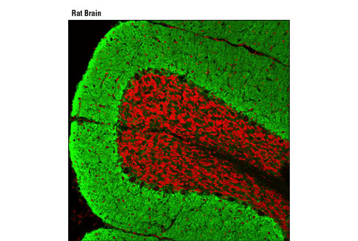 Immunofluorescence Image 1: EAAT1 (D44E2) XP® Rabbit mAb