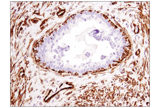 Immunohistochemistry Image 1: α-Smooth Muscle Actin (1A4) Mouse mAb (IHC Formulated)