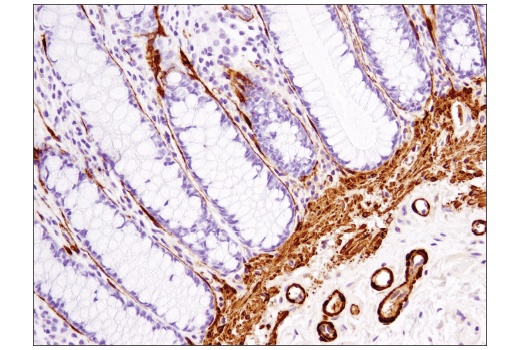 Immunohistochemistry Image 3: α-Smooth Muscle Actin (1A4) Mouse mAb (IHC Formulated)