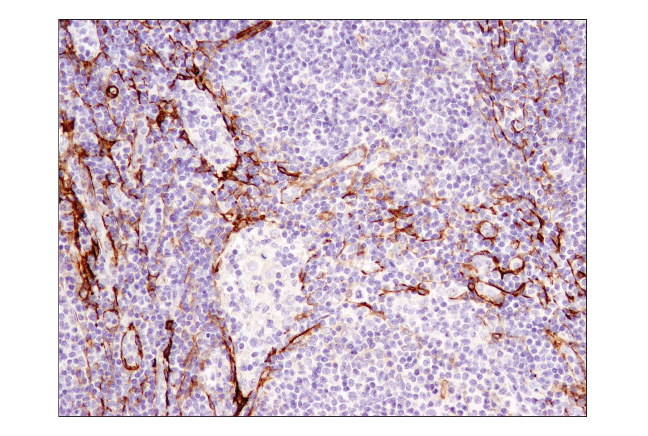 Immunohistochemistry Image 4: α-Smooth Muscle Actin (1A4) Mouse mAb (IHC Formulated)