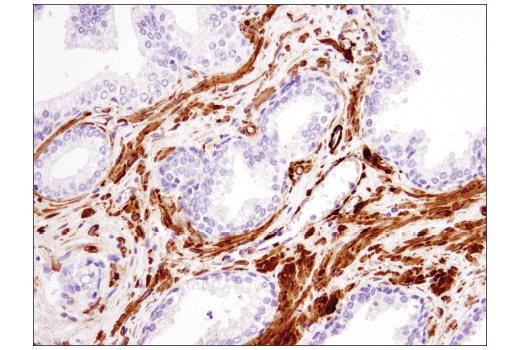 Immunohistochemistry Image 5: α-Smooth Muscle Actin (1A4) Mouse mAb (IHC Formulated)