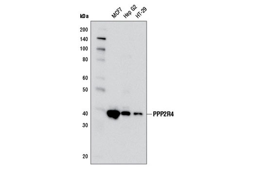Western Blotting Image 1: PPP2R4 (5G3) Mouse mAb