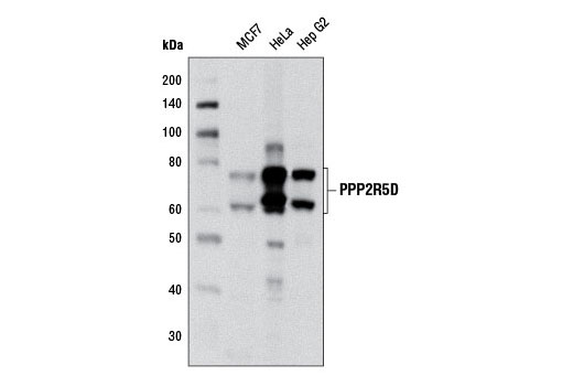 Western Blotting Image 1: PPP2R5D (H5D12) Mouse mAb