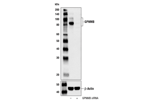 Western Blotting Image 2: GPNMB Antibody (Mouse Specific)