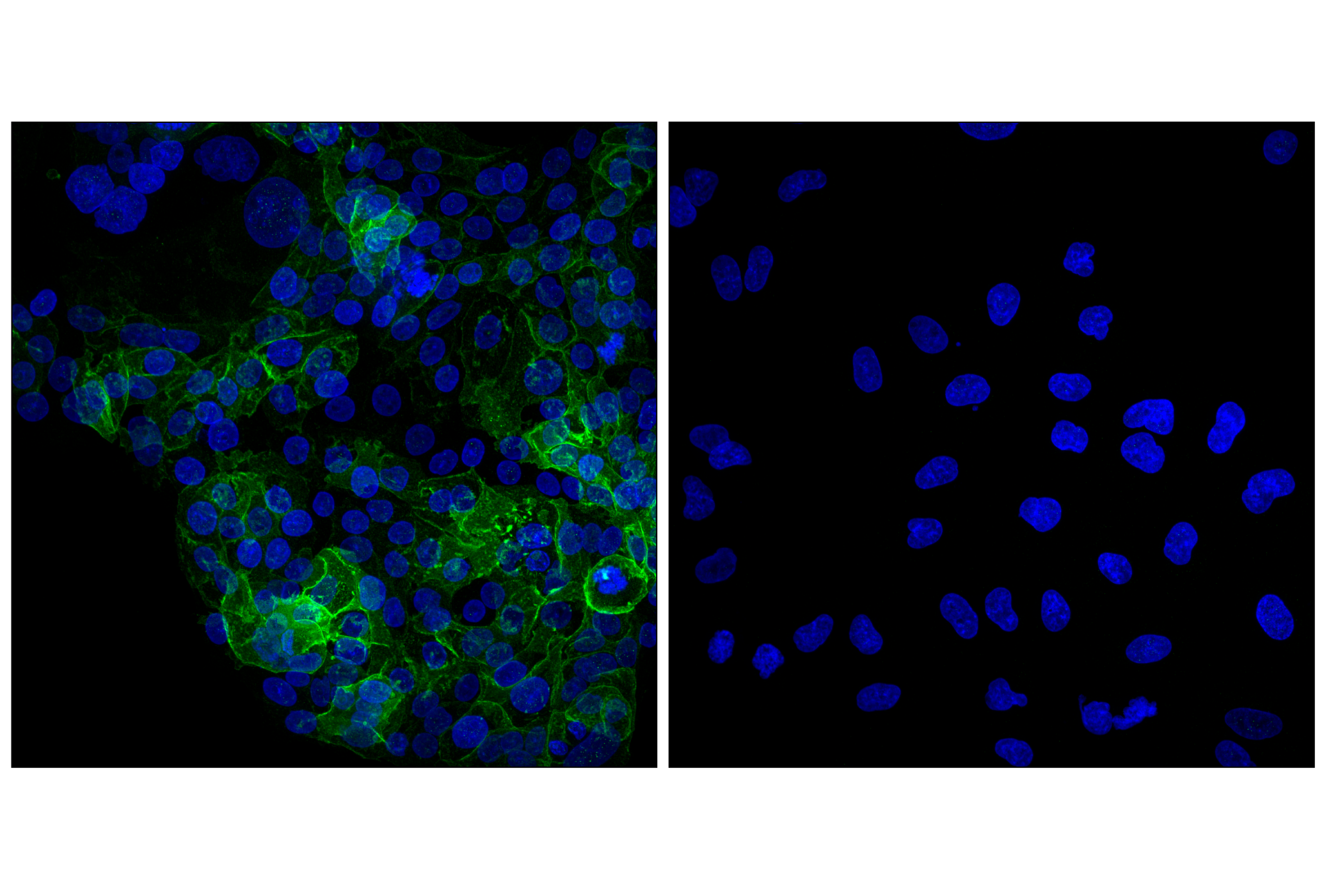 Immunofluorescence Image 2: EAAT1 (D44E2) XP® Rabbit mAb (BSA and Azide Free)