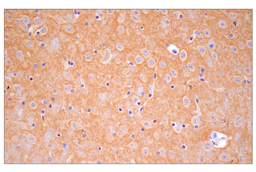 Immunohistochemistry Image 1: SynGAP (E4Y6I) Rabbit mAb