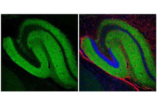 Immunofluorescence Image 1: SynGAP (E4Y6I) Rabbit mAb