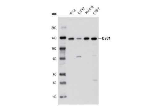 Western Blotting Image 1: DBC1 Antibody