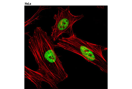 Immunofluorescence Image 1: DBC1 Antibody
