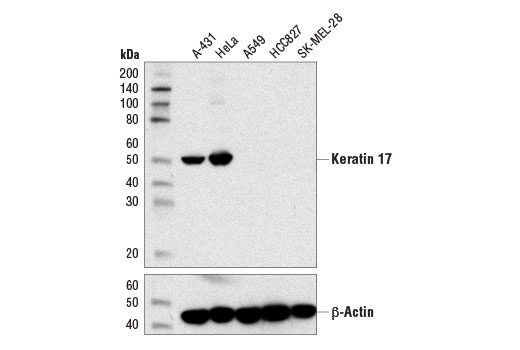 Western Blotting Image 1: Keratin 17 (D12E5) XP® Rabbit mAb (BSA and Azide Free)