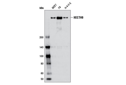Western Blotting Image 1: HECTH9 (AX8D1) Mouse mAb