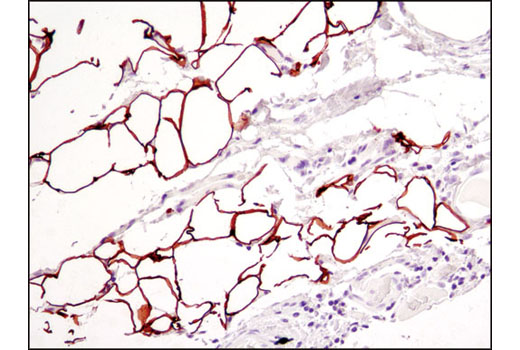 Immunohistochemistry Image 1: Perilipin-1 (D1D8) XP® Rabbit mAb (BSA and Azide Free)