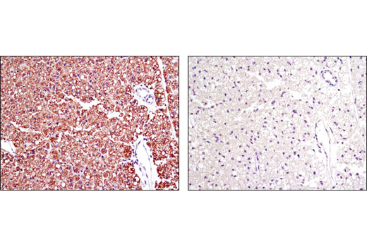 Immunohistochemistry Image 2: Perilipin-1 (D1D8) XP® Rabbit mAb (BSA and Azide Free)