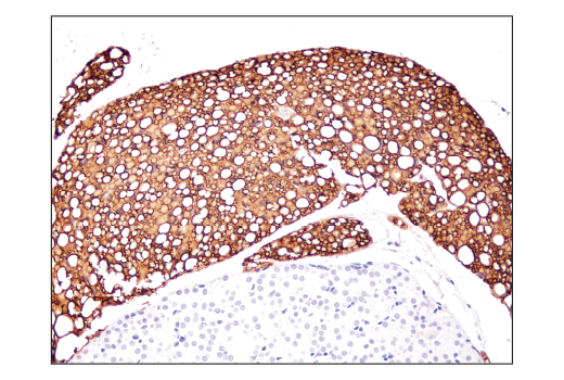 Immunohistochemistry Image 3: Perilipin-1 (D1D8) XP® Rabbit mAb (BSA and Azide Free)