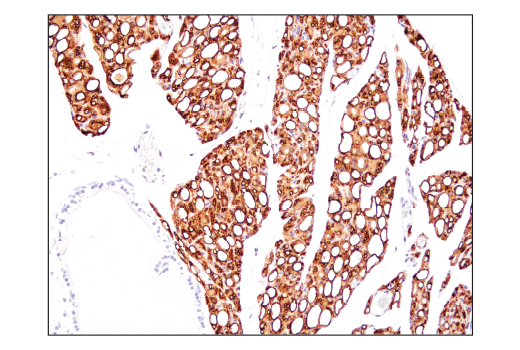 Immunohistochemistry Image 4: Perilipin-1 (D1D8) XP® Rabbit mAb (BSA and Azide Free)