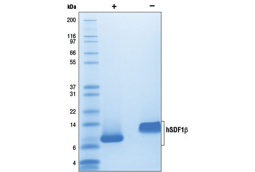  Image 2: Human Stromal Cell-derived Factor 1β/CXCL12 (hSDF1β)