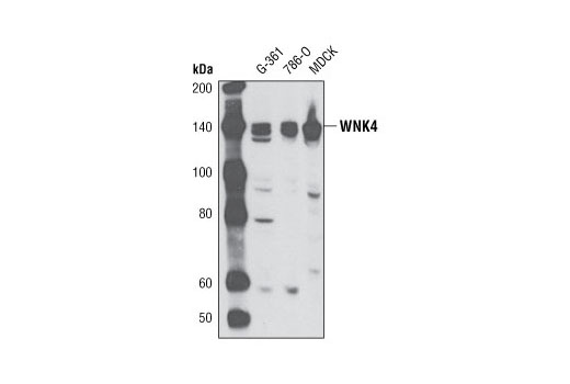 Western Blotting Image 1: WNK4 Antibody