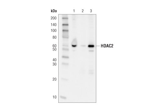 Immunoprecipitation Image 1: HDAC2 (D6S5P) Rabbit mAb
