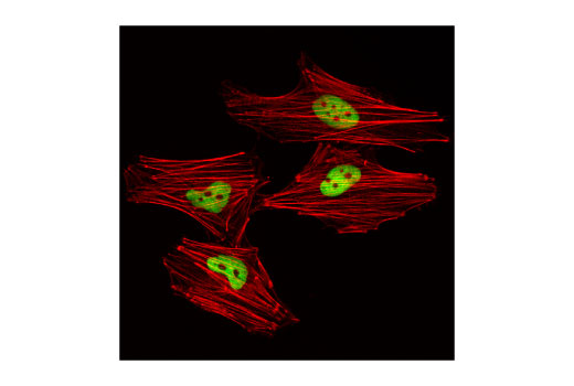 Immunofluorescence Image 1: HDAC2 (D6S5P) Rabbit mAb