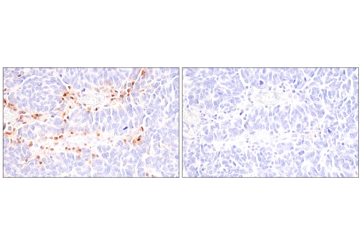 Immunohistochemistry Image 6: CCL5/RANTES (E9S2K) Rabbit mAb (BSA and Azide Free)