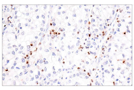 Immunohistochemistry Image 3: CCL5/RANTES (E9S2K) Rabbit mAb (BSA and Azide Free)