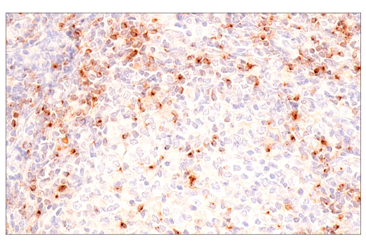 Immunohistochemistry Image 2: CCL5/RANTES (E9S2K) Rabbit mAb (BSA and Azide Free)