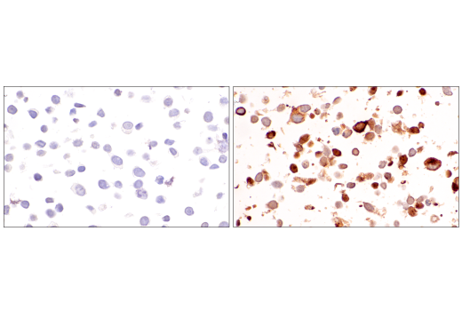 Immunohistochemistry Image 7: CCL5/RANTES (E9S2K) Rabbit mAb (BSA and Azide Free)