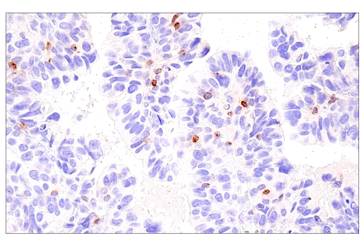 Immunohistochemistry Image 4: CCL5/RANTES (E9S2K) Rabbit mAb (BSA and Azide Free)